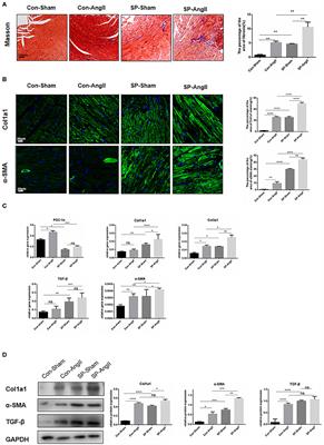 Cardiac Fibroblast-Specific Knockout of PGC-1α Accelerates AngII-Induced Cardiac Remodeling